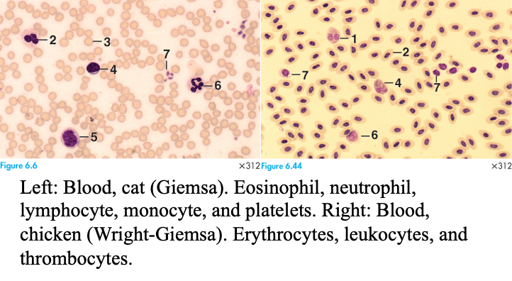<p>Stains blood w/eosin, azure, + methylene blue</p><ul><li><p>similar to Wright’s stain</p></li><li><p>classic lymphoma stainers</p></li></ul><p></p>