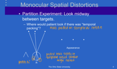 <p>Partition Experiment</p><p>Where would a patient look if there was more "temporal" packing of the OD?</p>