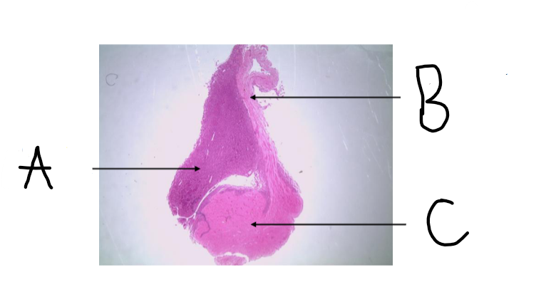 <p>what is A?</p>
