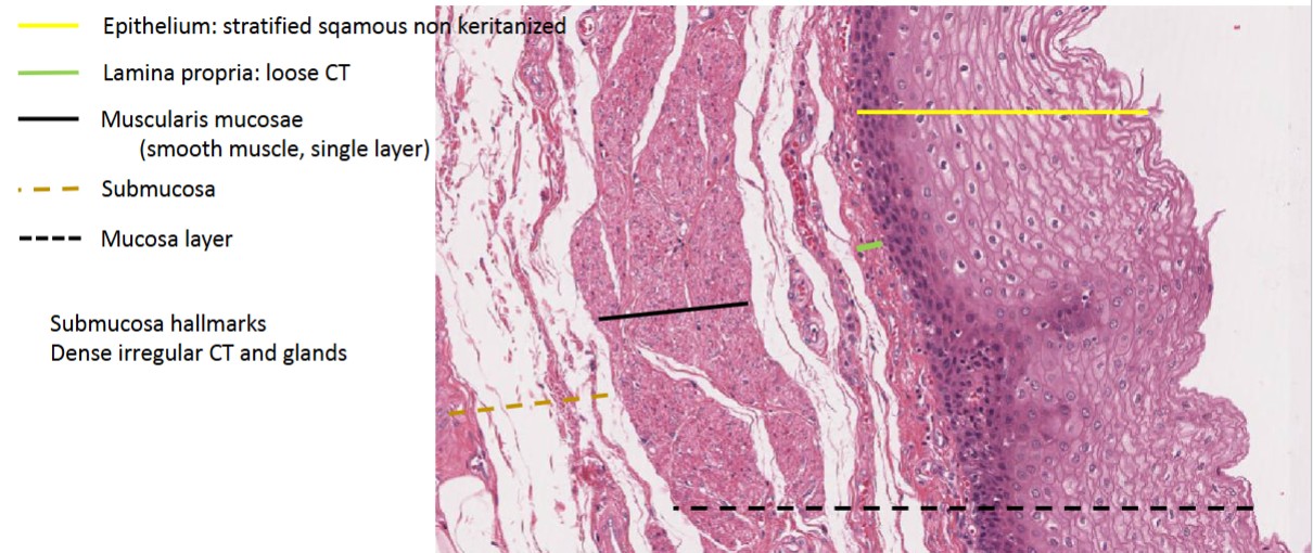 <p>smooth muscle</p>