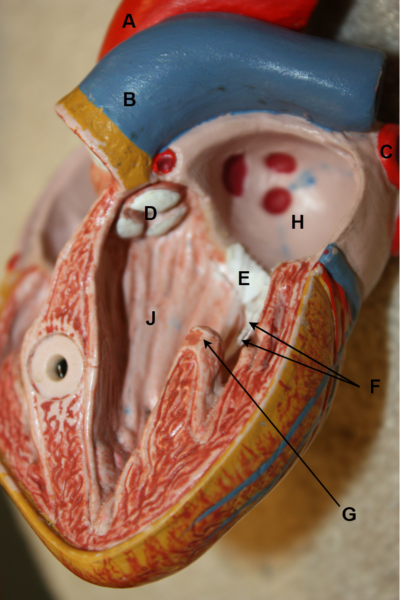 <p>In the images above and below, identify blood vessels A, B, and C; structures D, E, F, and G; and chambers H and J. &nbsp;(There is no letter I.)</p>