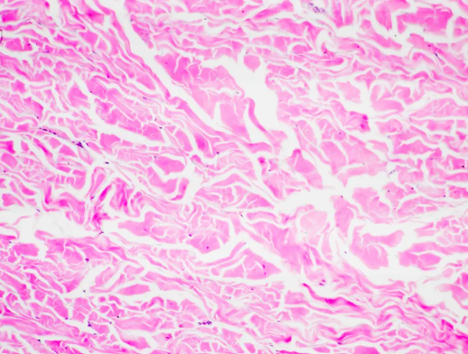<p>name it → see it</p><p>collagen fibers in many directions</p><ul><li><p>wraps organs &amp; joints, the dermis of the skin, layer of digestive tract</p></li></ul><p></p>