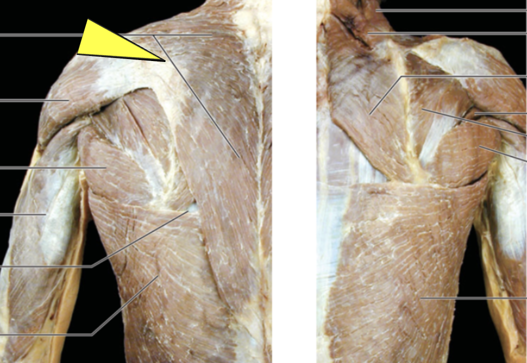 <p>ID muscle</p>