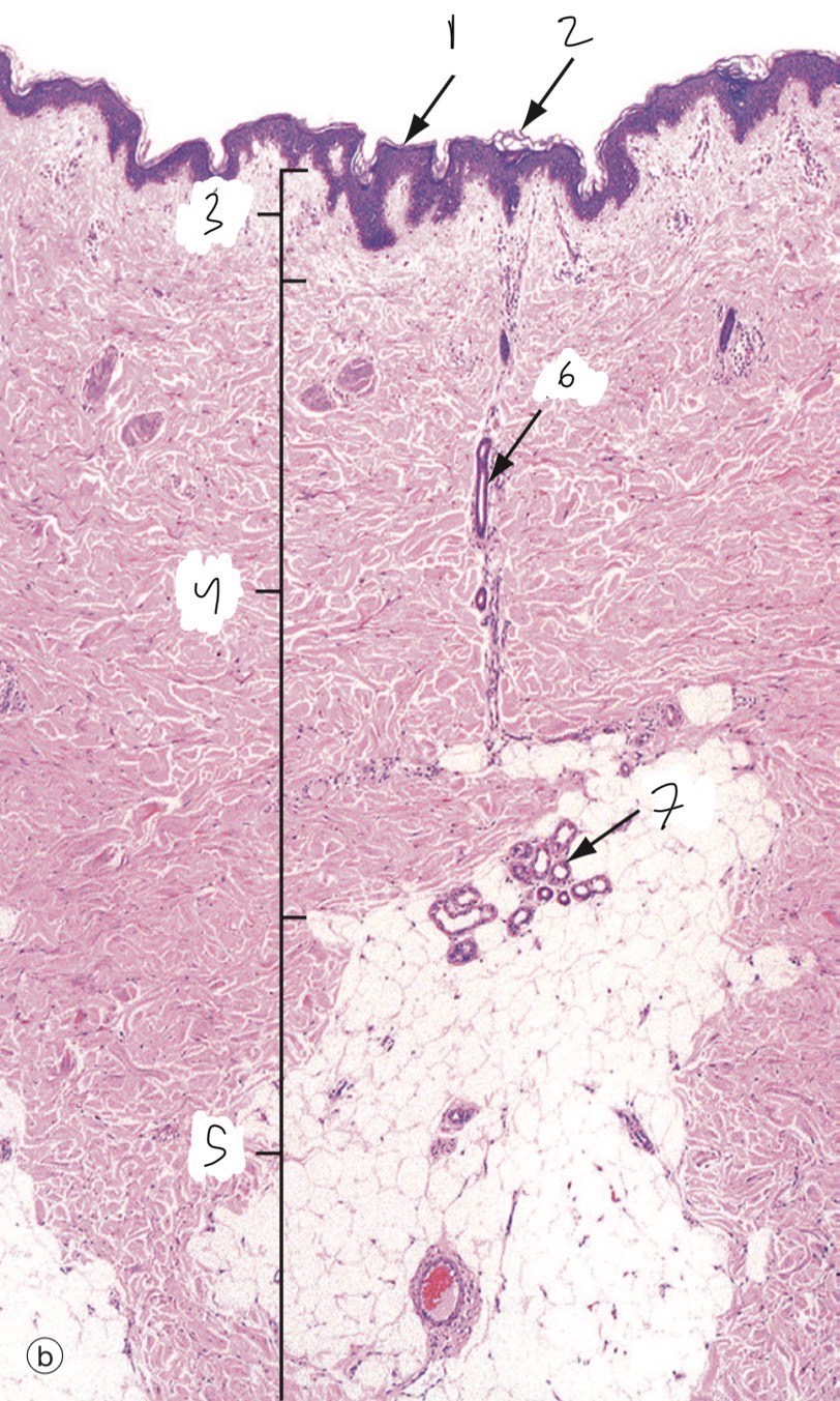 <p>Identify the layers?</p>