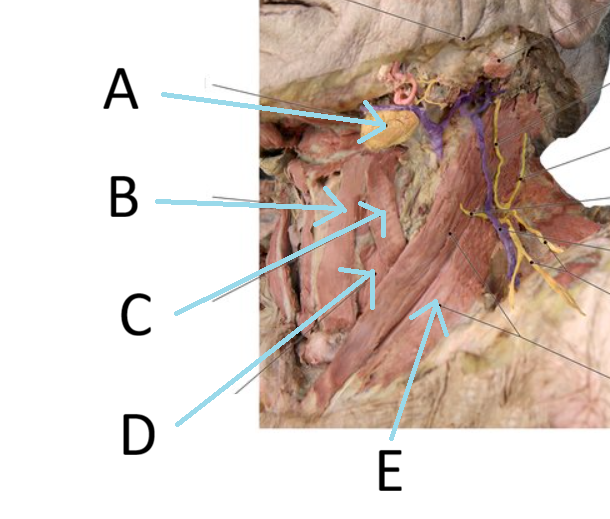 <p>E</p>