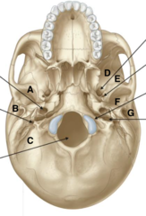 <p>Identify the structure at D</p>