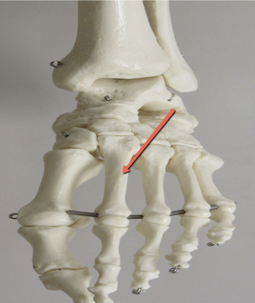 <p><strong>Identify the bone marking indicated by the pointer.</strong></p>