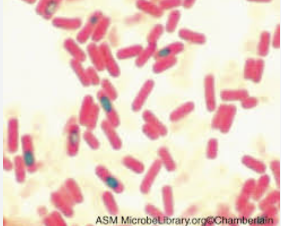 <p>What kind of stain is this ?</p>