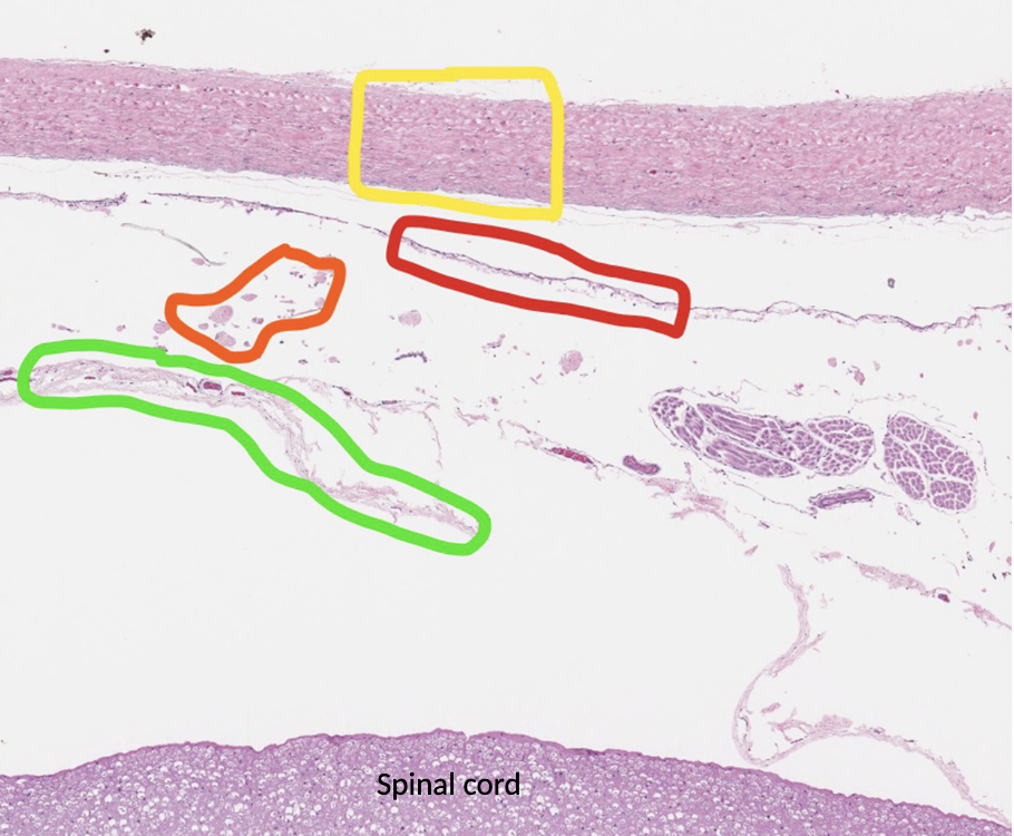 <p>ID the indicated layers of meninges: yellow, red, orange, green</p>