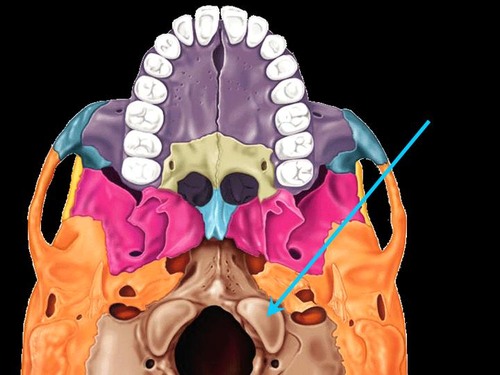 term image