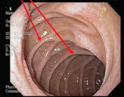 <ul><li><p>Mixes chyme, pancreatic secretions, and bile</p></li><li><p>Shallow plicae</p></li></ul><p></p>