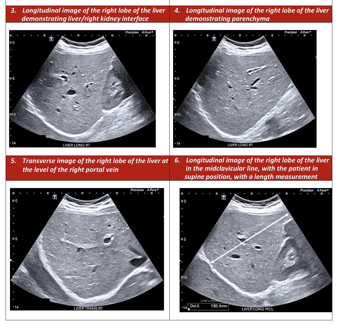 <p>Right Liver Longitudinal Survey</p>
