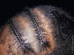 <p>History of tight braids</p>