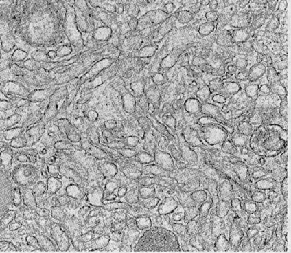 <p>A type of endoplasmic reticulum that lacks ribosomes and is primarily involved in lipid synthesis, metabolism of carbohydrates, and detoxification of drugs and poisons. </p>