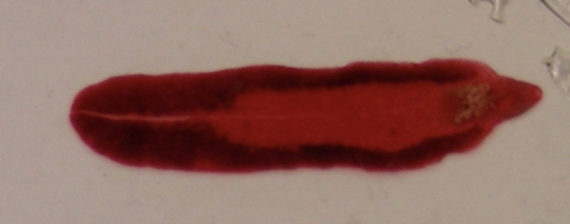 <p>What helminth/fluke/parasitic worm is this?</p>