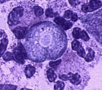 <p>What parasite is this?</p>