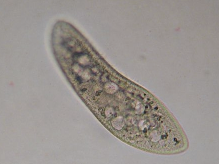 <p>What protist is this? (genus name)</p>