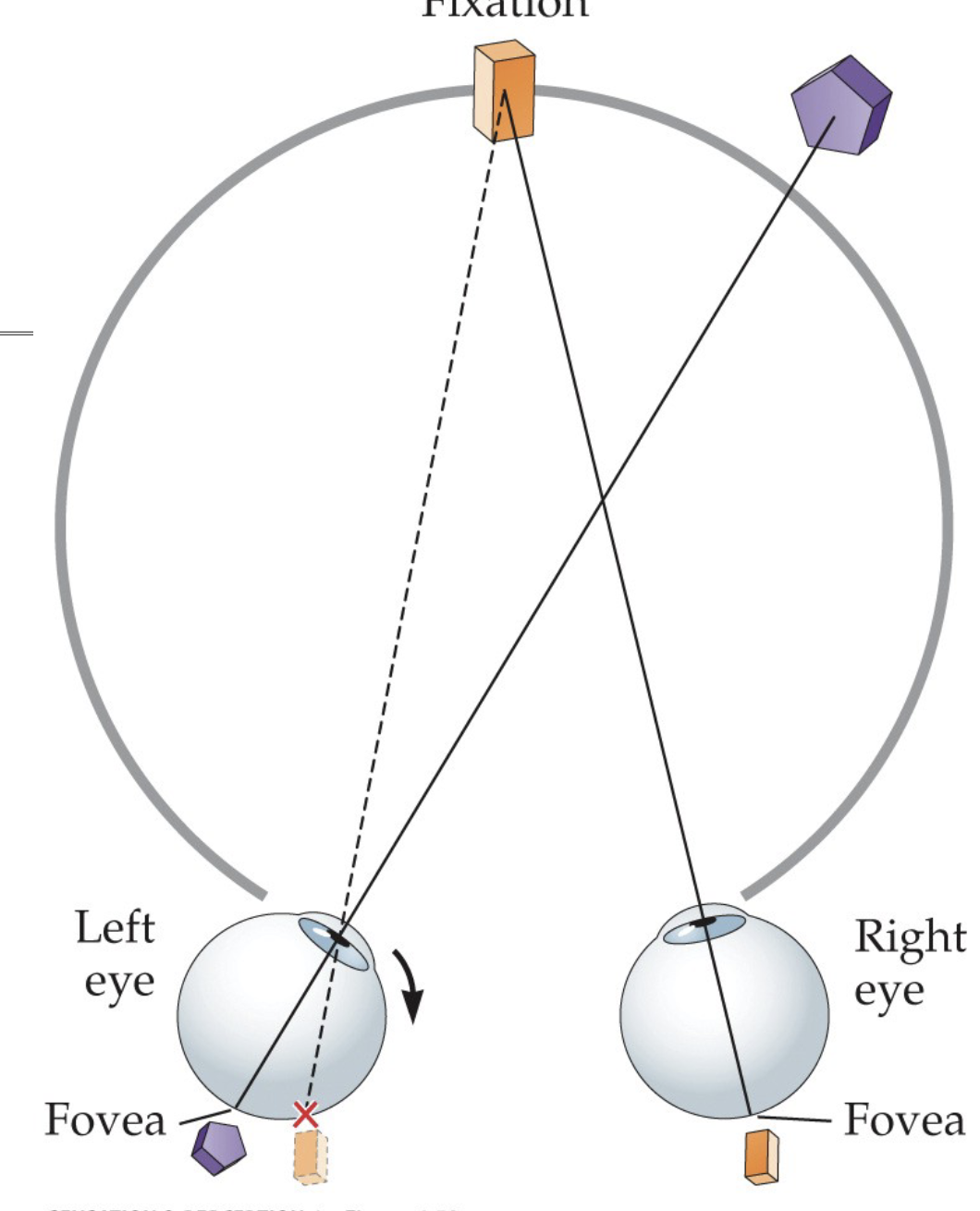<p>Strabismus can cause stereoblindness, which is an inability to use binocular disparity as a depth cue. This is because strabismus is a misalignment of the eyes such that an object is imaged on the foveal area of one eye and on a nonfoveal area of the other eye. This throws off triangulation, meaning that items that should have single vision (in the focal point) will not anymore. </p>