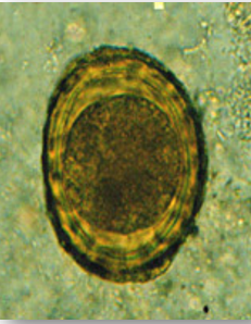 <p>fertilized ascaris egg, still at unicellular stage</p><p>passed in stool</p>