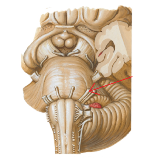 <p>Cranial Nerve VII</p>