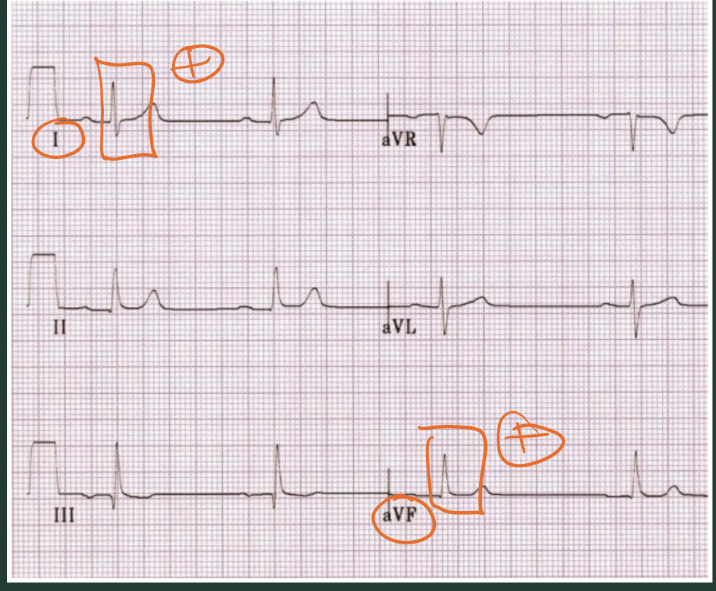 <p>What axis quadrant?</p>