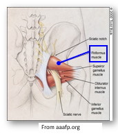 <p>external roation and abduction of hip</p><p>attaches to sacrum and anterior/posterior trochanter</p>