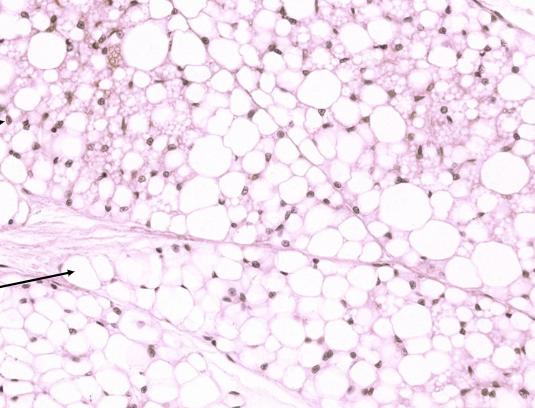 <p>identify the tissue</p>