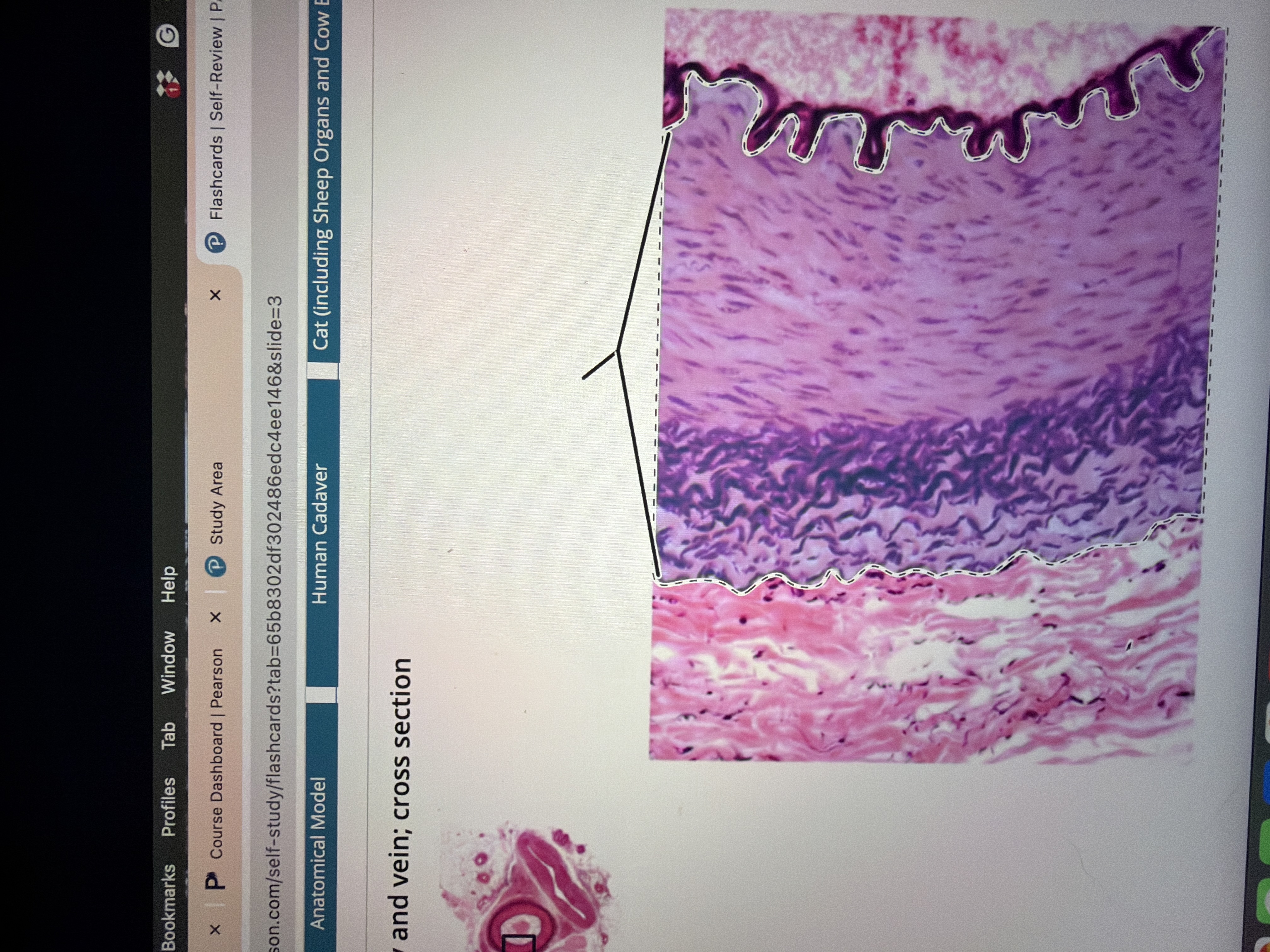<p>Artery </p>