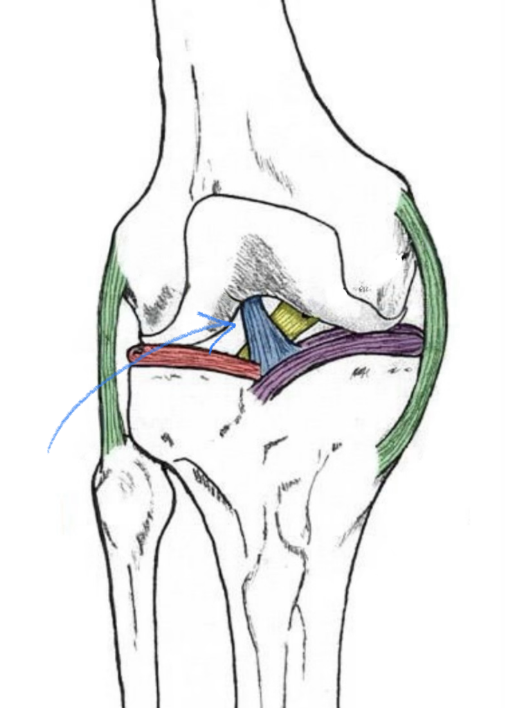 term image