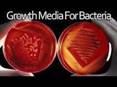 <p>A growth medium that inhibits some bacteria while promoting others.</p>