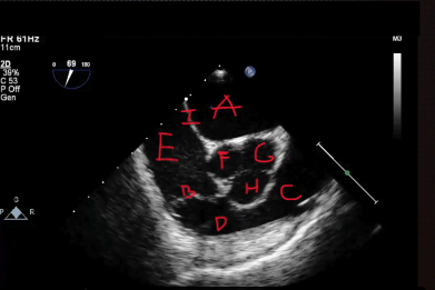 <p>What is at D? </p>