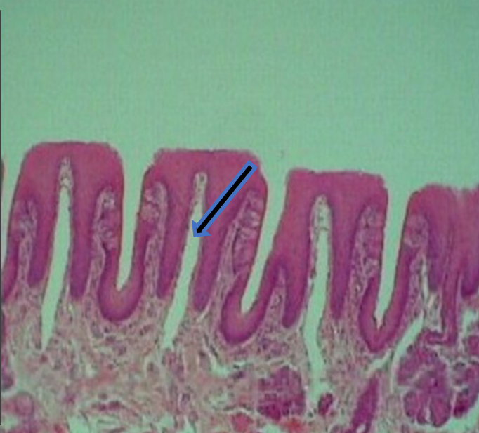 knowt flashcard image