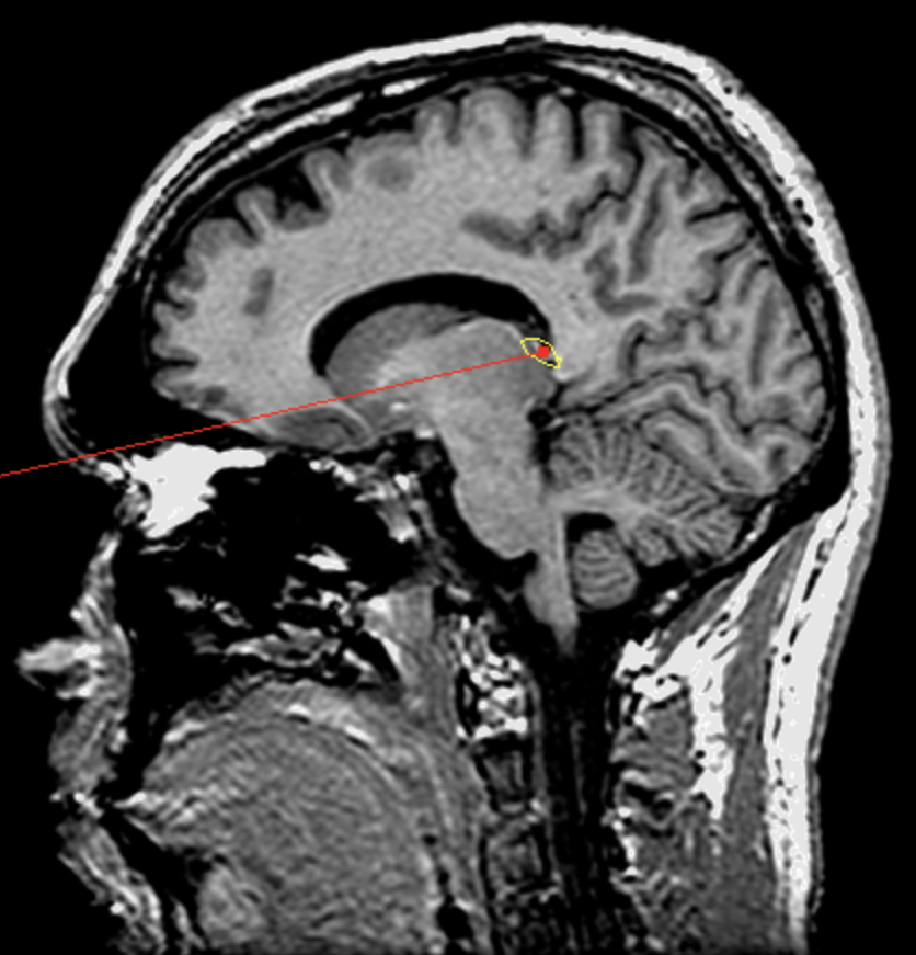<p>What is the area highlighted called?</p>