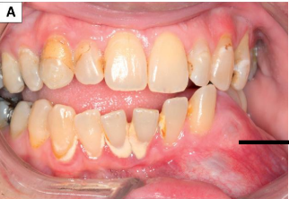 <p>Clinical presentation of cysts and tumors of jaw</p>