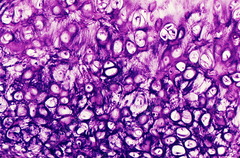 <p>Connective tissue. Scattered cells (chondrocytes) and found in "caves". Very flexible due to elastic fibers</p>