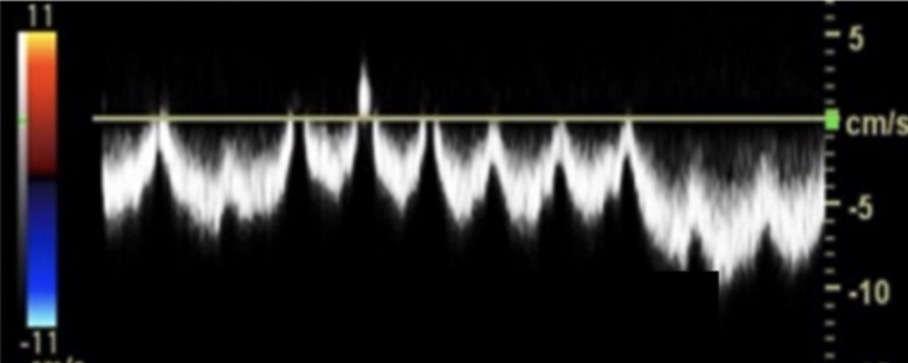 <p>How would you describe this waveform?</p>