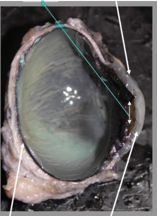 <p>What is the arrow pointing at?</p>