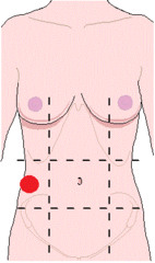 <p>identify the region of the abdomen:</p>