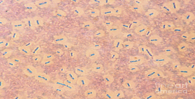 <p><span>covering that provides protection made of polysaccharides or other materials, “halo” seen on gram stain as it does not stain, virulence factor. </span></p><p><span>polysaccharides or polypeptides </span></p><p><span>provides defense against phagocytosis (virulence factor)</span></p><p><span>facilitates and maintains bacterial colonization of biologic and inanimate surfaces </span></p>