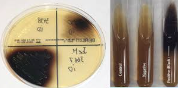 <p><u>Selectief en electief</u> → vnl. voor de isolatie van Enterococcus spp. en sommige Streptococcus spp. (groep D) (uit urine)</p><p><u>Selectieve stoffen:</u> galzouten en Na-azide</p><ul><li><p>Galzouten remmen de groei van de meeste grampositieve bacteriën, buiten Enterococcus spp. en groep D Streptococcus spp.</p></li><li><p>Na-azide remt de groei van gramnegatieve bacteriën</p></li></ul><p><u>Groei van:</u> Groep D Streptokokken (Enterococcus spp. en sommige Streptococcus spp.) </p><p><u>Electieve stoffen:</u> esculine en ijzer(III)ionen (ijzer-ammonium-citraat) </p><ul><li><p>Esculinepositieve kolonies kunnen esculine wel hydrolyseren/afbreken → afbraakproducten reageren met ijzerzouten → zwart precipitaat = zwartverkleuring → Enterococcus spp. en groep D Streptococcus spp. → bruinzwart </p></li><li><p>Esculinenegatieve kolonies kunnen esculine niet hydrolyseren/afbreken en vertonen geen zwartverkleuring → kleurloos/lichtbruin </p></li></ul><p><strong>37°C</strong></p>