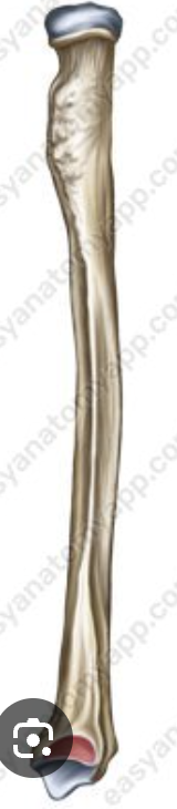 <p>whats the red</p>