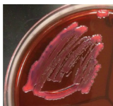 <p><strong>Dark Purple / Black / Pink</strong> Colonies on EMB:</p>