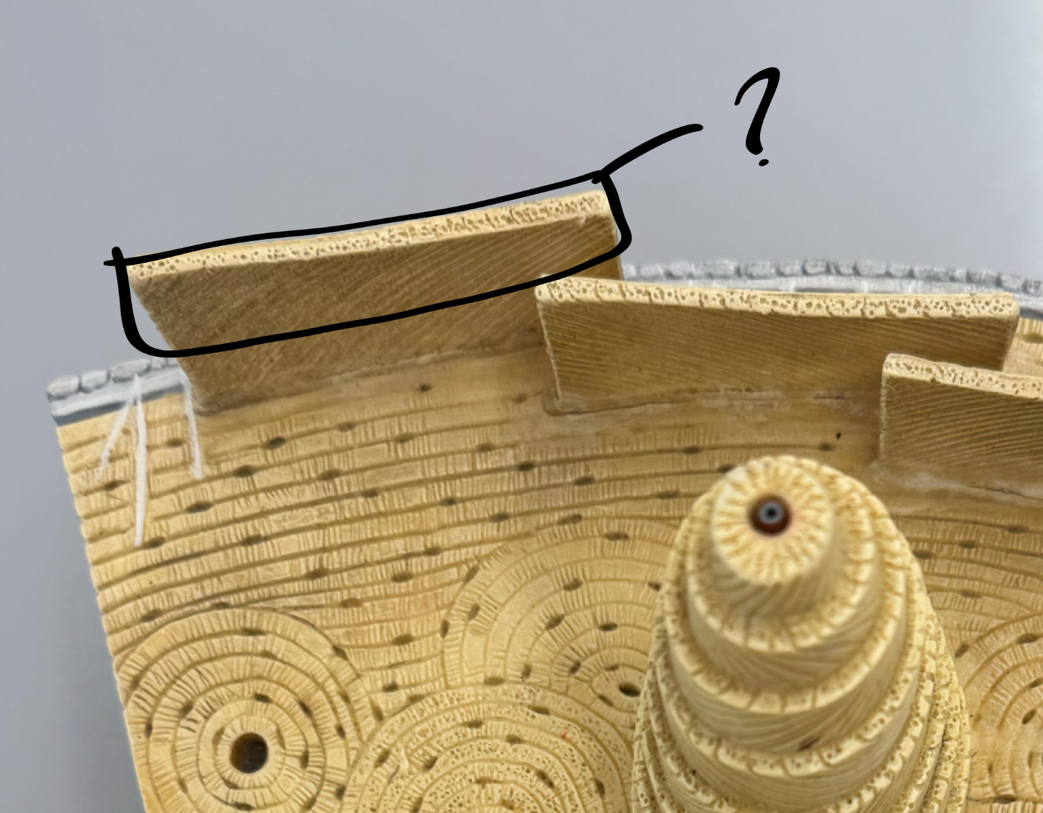 <p>inner: cellular layer, outer: fibrous layer</p>