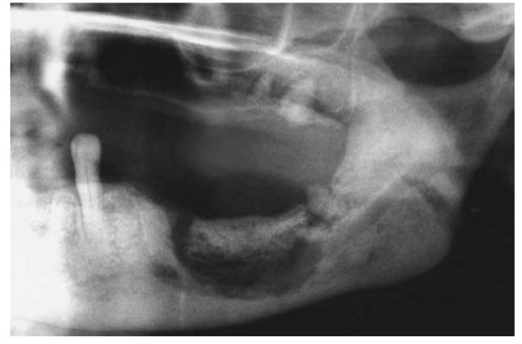 <p>CHẨN ĐOÁN ?</p>