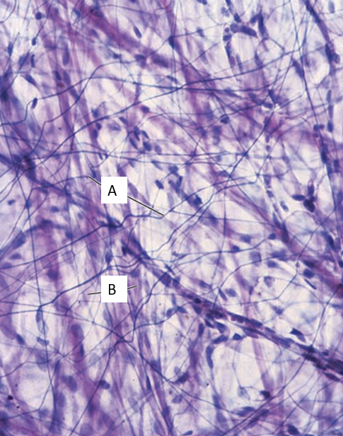 <p>Identifiy</p>