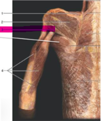 <p>Name this muscle</p>