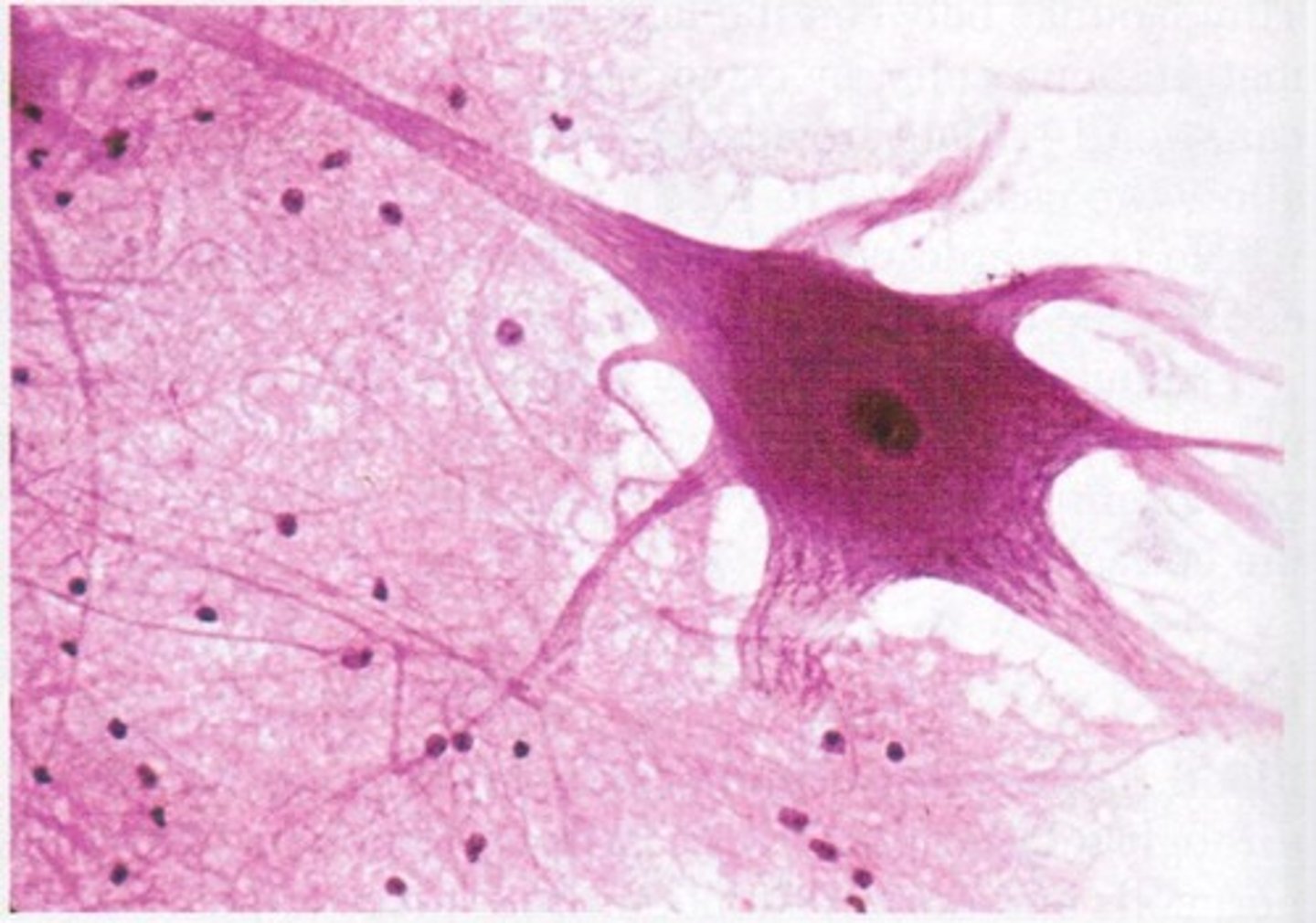 <p>Highly cellular, Contains neurons that conduct electrical impulses, Contains supportive cells (glial cells)</p>