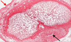 <p>give the histological classification of the epithelium pointed to by the red arrow</p>