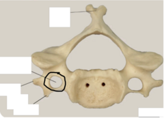 <p>transverse foramen</p>
