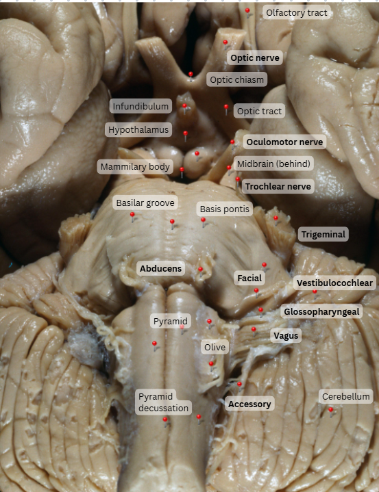 knowt flashcard image
